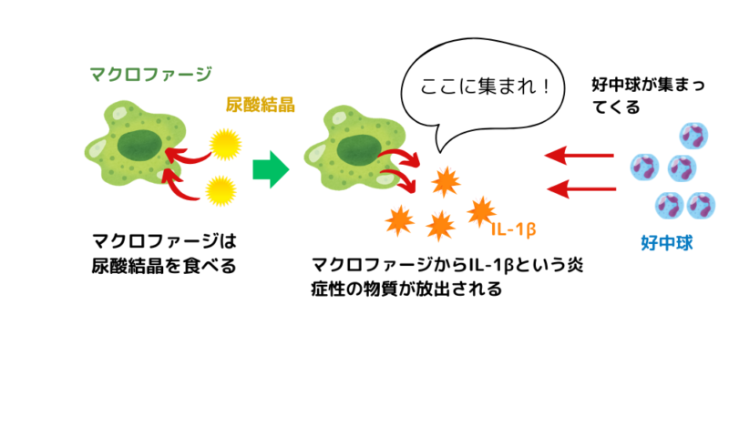 痛風機序1