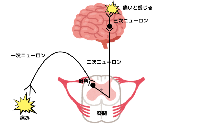 痛みが起こる機序